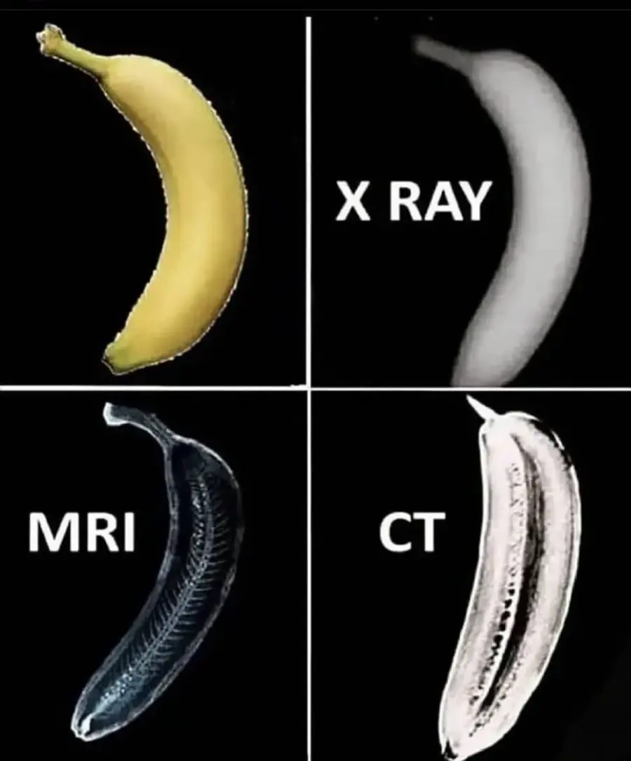 바나나 CT, Mri, X ray 사진 | mbong.kr 엠봉