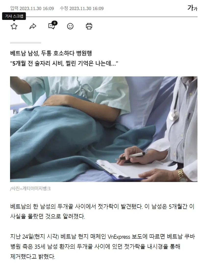 두통 호소하던 베트남 男, 두개골서 젓가락 발견 | mbong.kr 엠봉