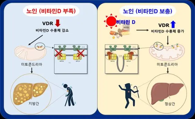 비타민D, 노인성 지방간 예방 세계 최초 규명 | mbong.kr 엠봉