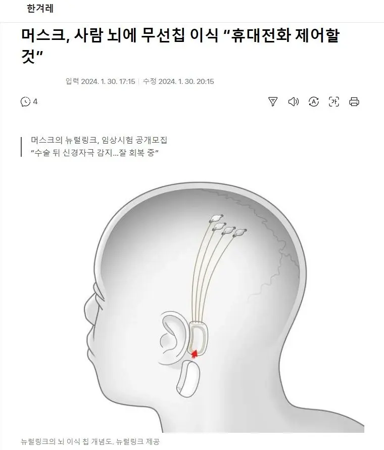 머스크, 사람 뇌에 무선칩 이식 휴대전화 제어할 것. | mbong.kr 엠봉