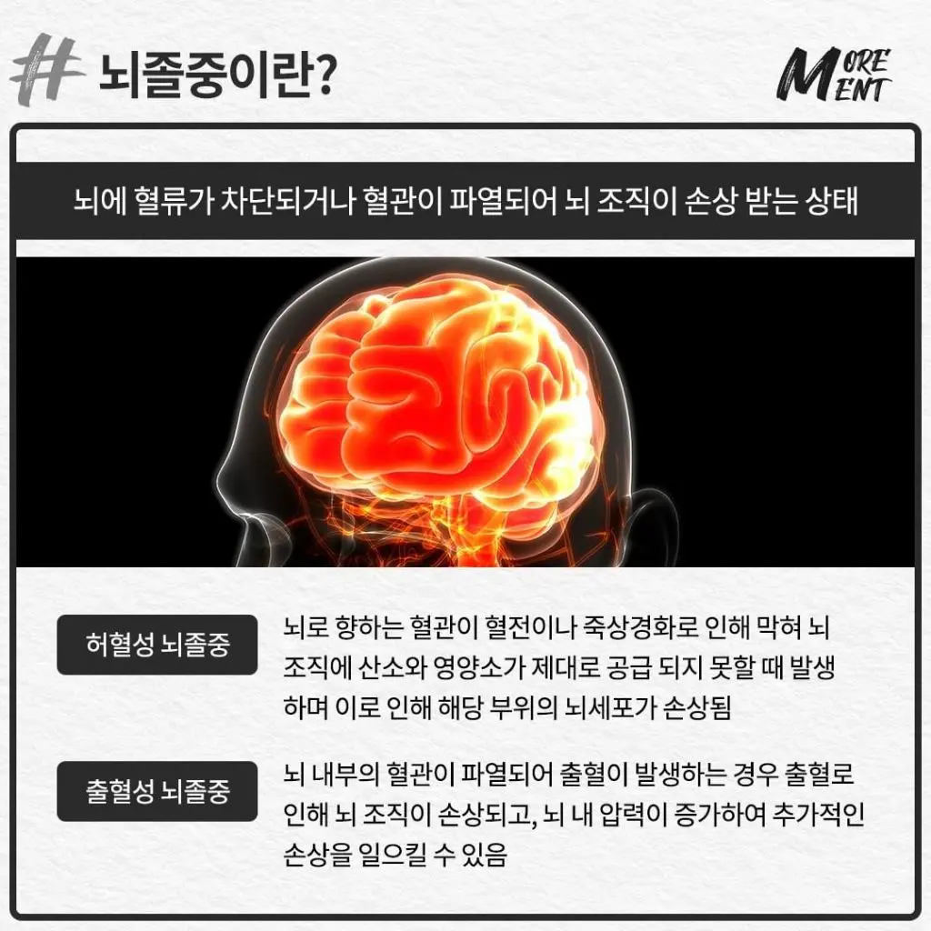 이 증상 있다면 젊은 뇌졸중 위험 신호.jpg | mbong.kr 엠봉