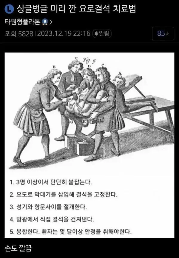 충격적인 옛날 요로결석 치료법 ㄷㄷㄷㄷ | mbong.kr 엠봉