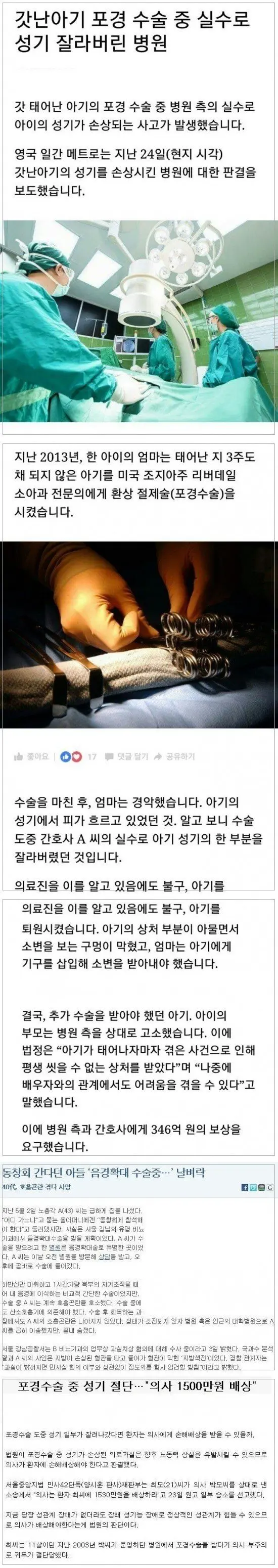 실수로 성기를 잘라버린 병원.jpg | mbong.kr 엠봉