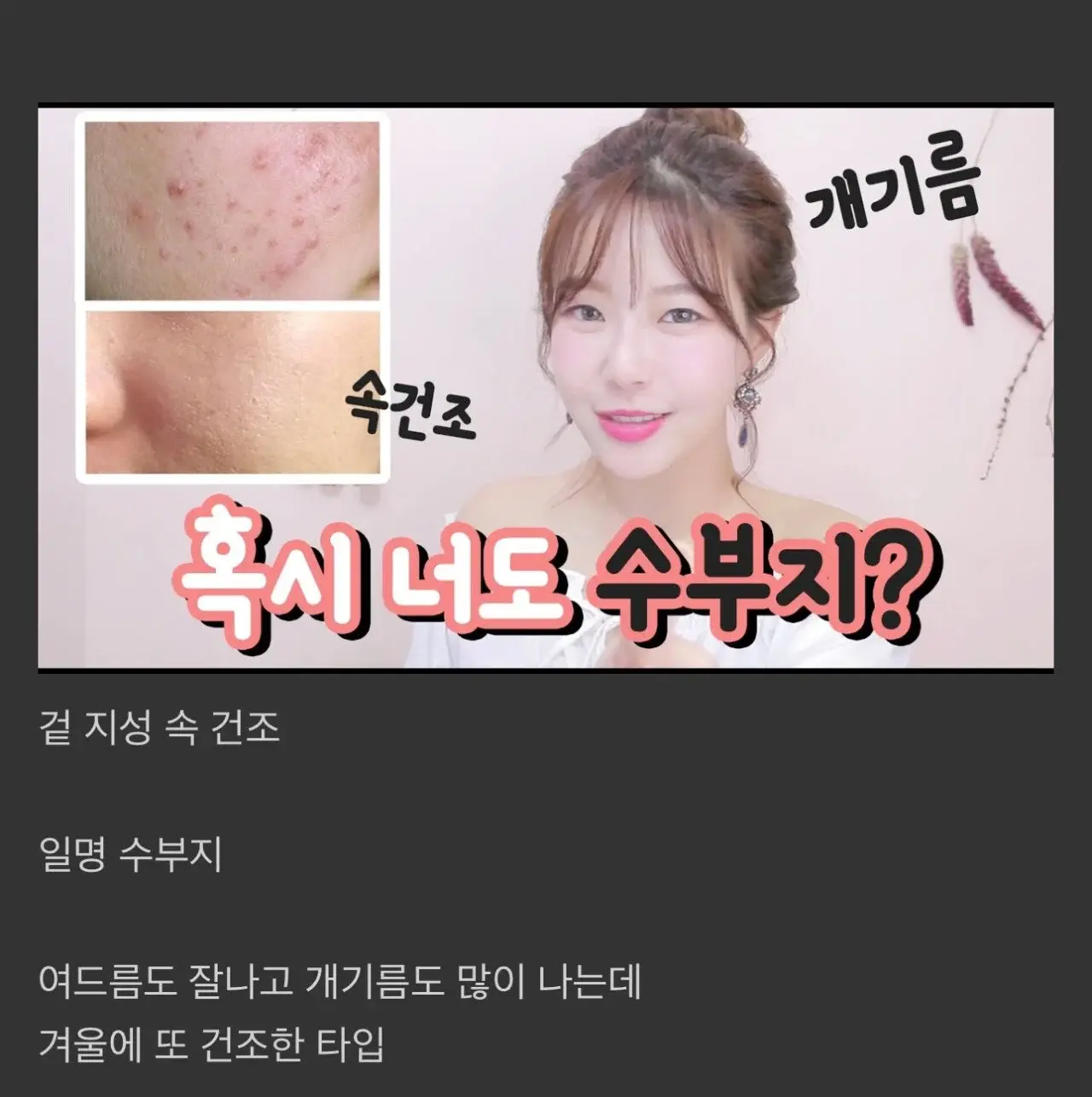 피부과 의사들이 최악으로 뽑은 피부 타입 | mbong.kr 엠봉