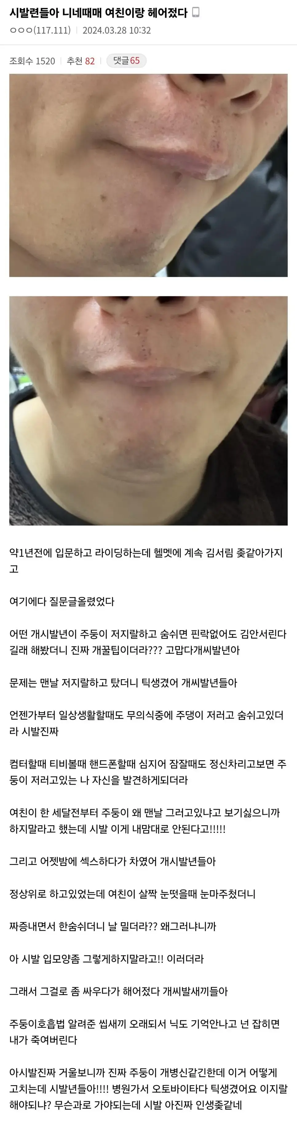 주둥이 때문에 여친이랑 헤어진 바갤러 | mbong.kr 엠봉