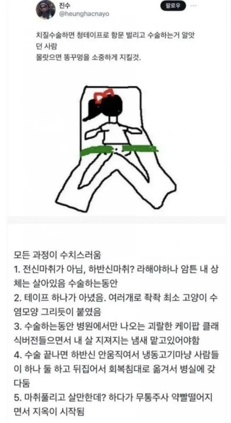 수치플 그잡채인 실제 치질수술 과정 | mbong.kr 엠봉