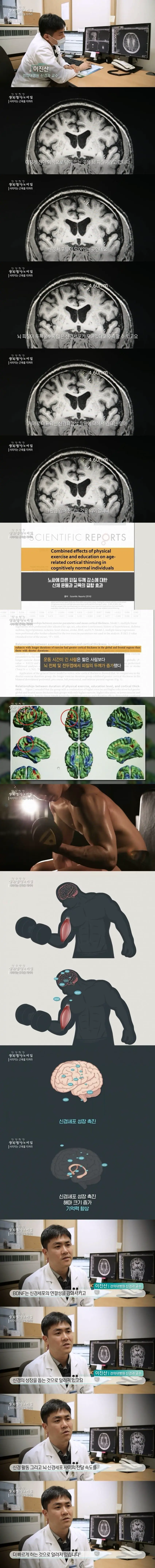 근육이 뇌 기능에 미치는 영향.jpg | mbong.kr 엠봉