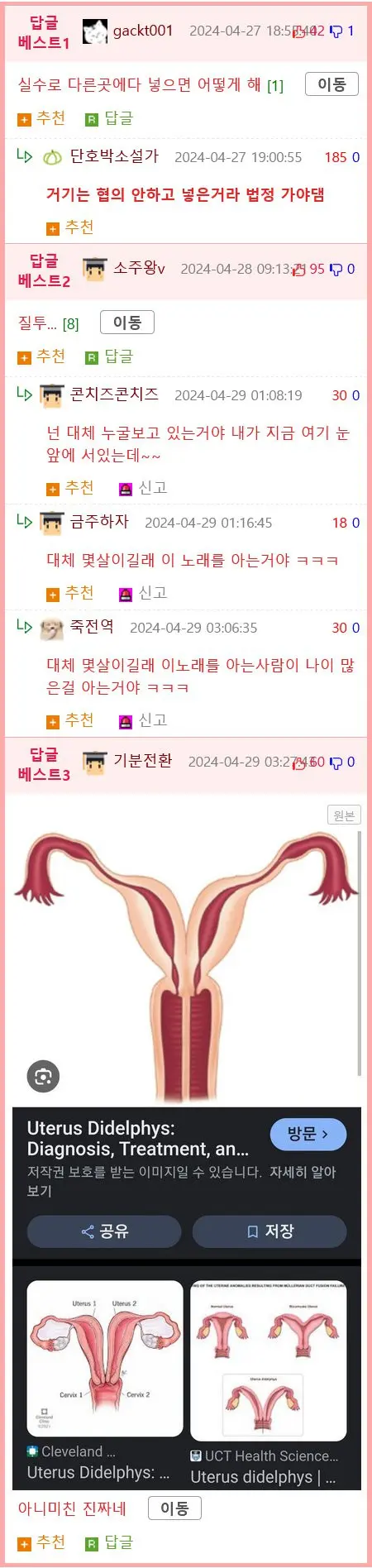 19) 질과 자궁을 2개 가진 여성 | mbong.kr 엠봉