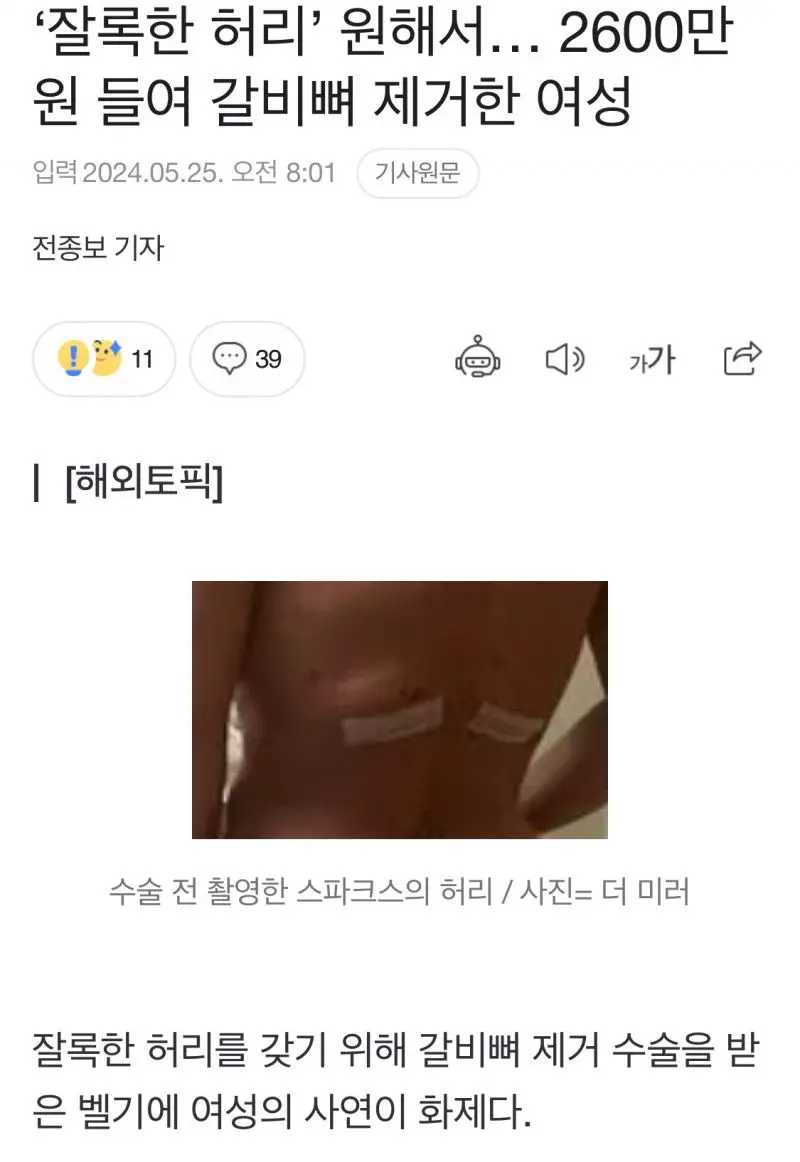 갈비뼈 제거에 2600만원 지불한 여성 | mbong.kr 엠봉