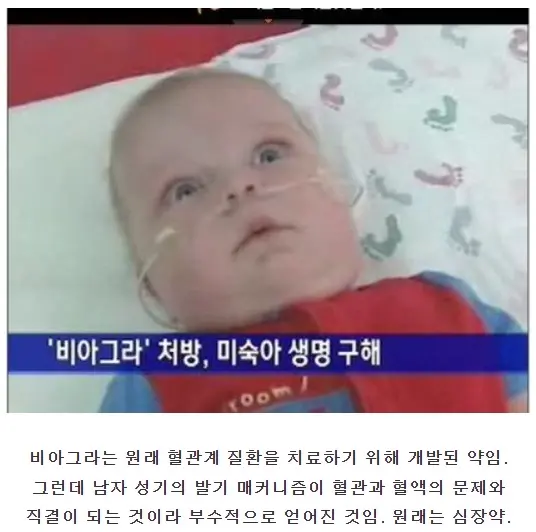비아그라먹은 아기. | mbong.kr 엠봉