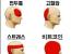 두통의 종류