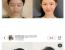 중국 여자들 사이에서 유행한다는 귀 성형