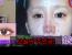 한국에서 성형 상담받는 일본여자.mp4